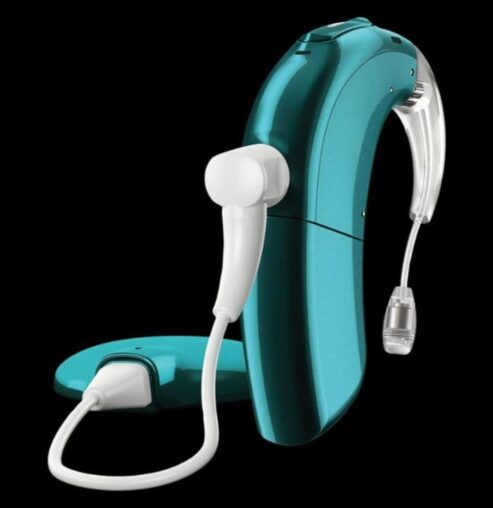 Roban el implante coclear a un niño en la Playa de La Antilla: «Sin él no puede oír»​