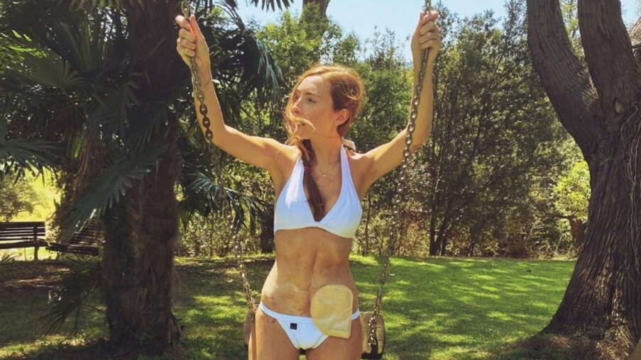 El mensaje de Tanit Tubau sobre la discapacidad «que no se ve»: dar visibilidad, hablar sin tabúes y pedir comprensión​